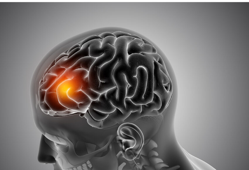 Effects of Alcohol on Tumour Growth, Metastasis, Immune Response, and Host Survival