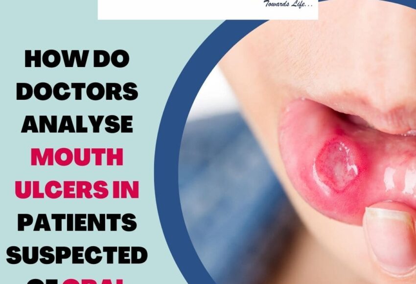 Mouth cancer treatment in Pune