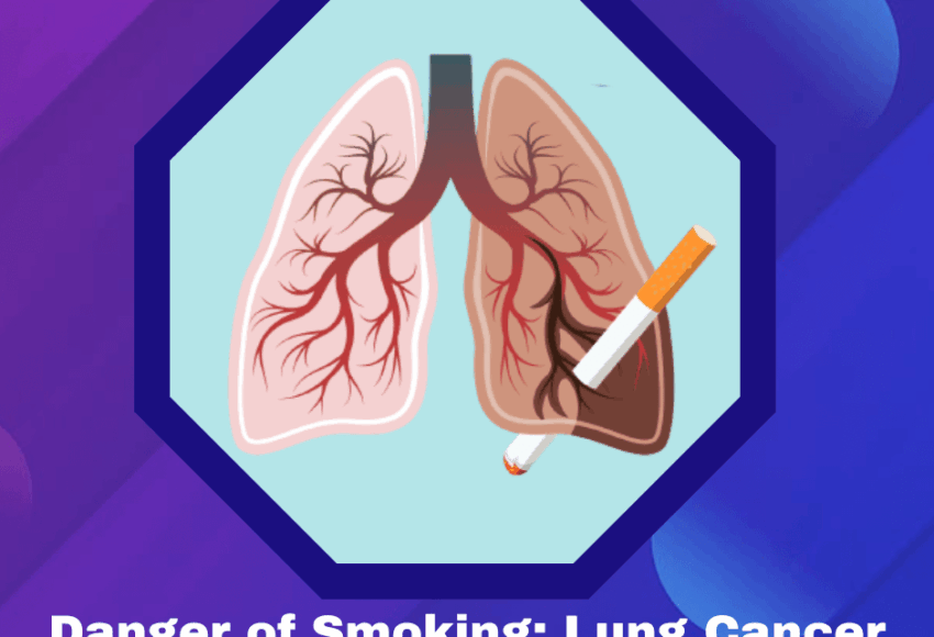 Lung cancer treatment in pune