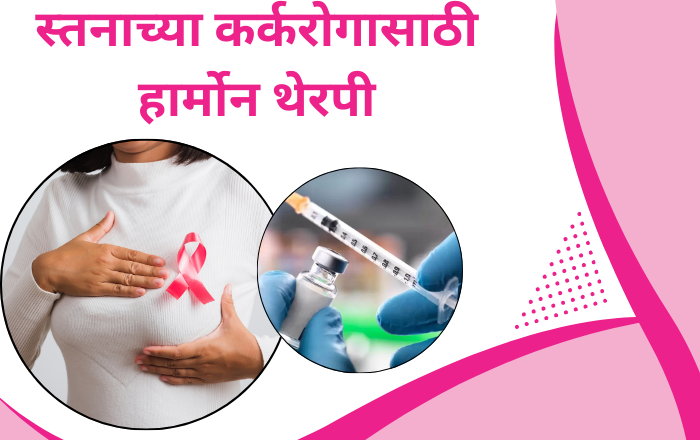 स्तनाच्या कर्करोगासाठी हार्मोन थेरपी - Hormone Therapy For Breast Cancer