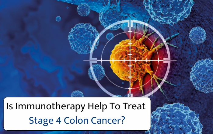 Is Immunotherapy the Key to Treating Stage 4 Colon Cancer?